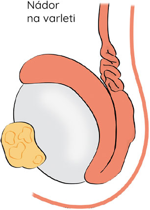 prsakoule